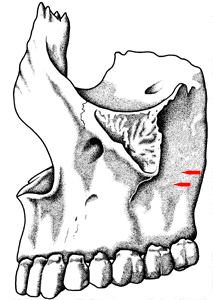 Corpul maxilarului