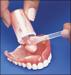 Rebazarea unei proteze dentare